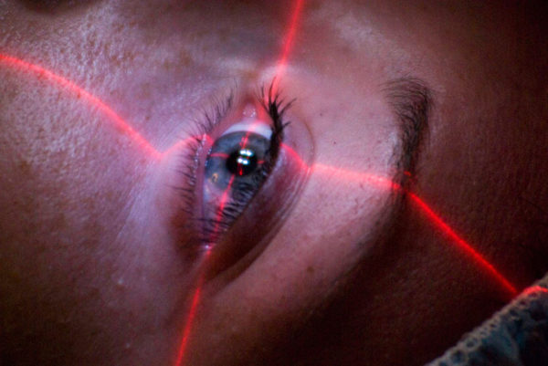 Laser Ματιών - Επέμβαση - Οφθαλμίατρος Θεσσαλονίκη - Dr Καραμήτσος Αθανάσιος