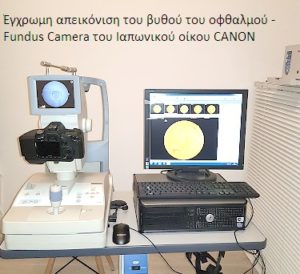 Οπτική Τομογραφία Συνοχής OCT - Οφθαλμίατρος Θεσσαλονίκη - Dr Καραμήτσος Αθανάσιος