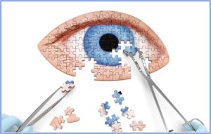 Χειρουργική του Οφθαλμού Μεταπτυχιακό Πρόγραμμα Σπουδών 2023 - Οφθαλμίατρος Καραμήτσος Αθανάσιος